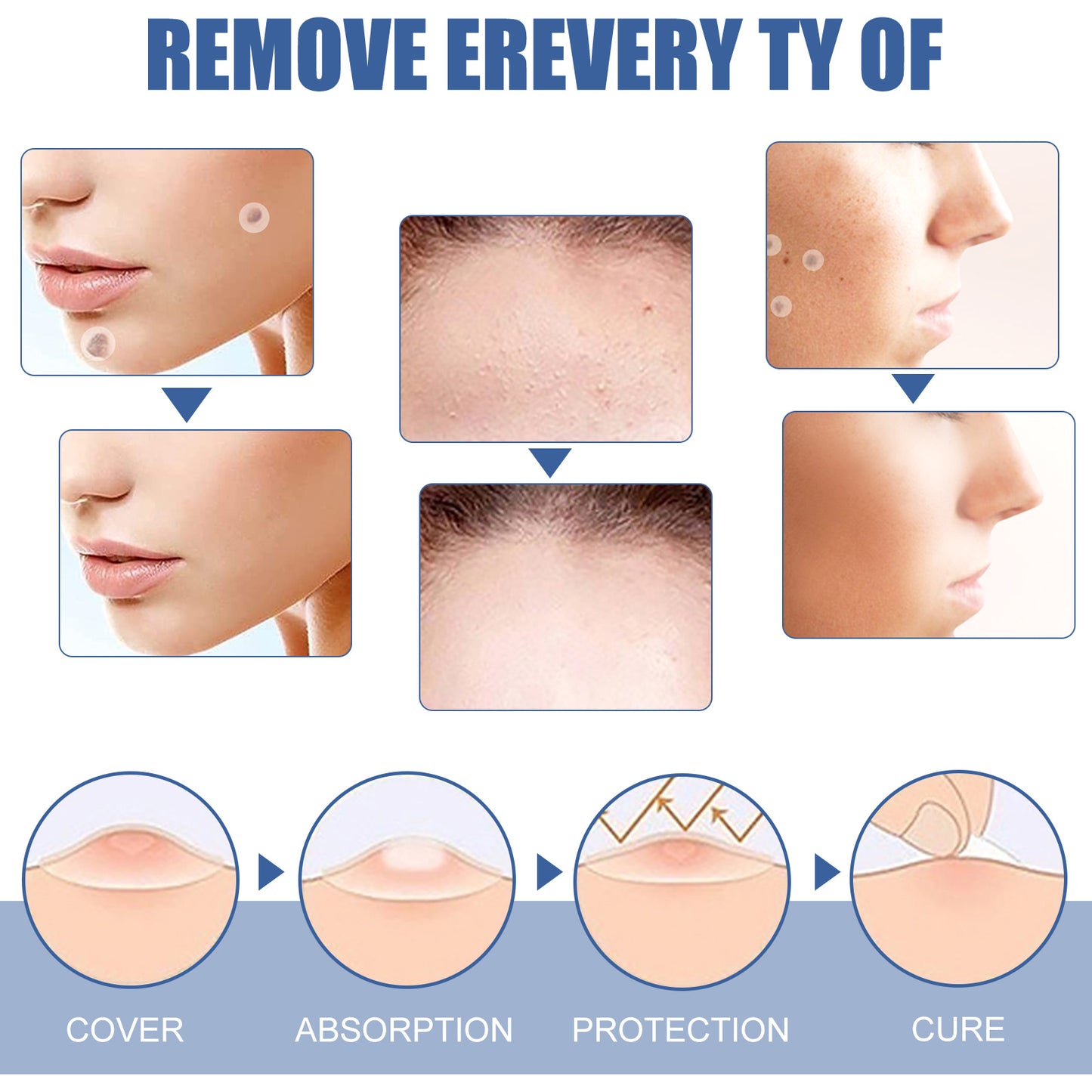 EELHOE Gram Wart Corns Patch, Skin Gram Wart Flesh Mole Black Mole Clean And Care Patch