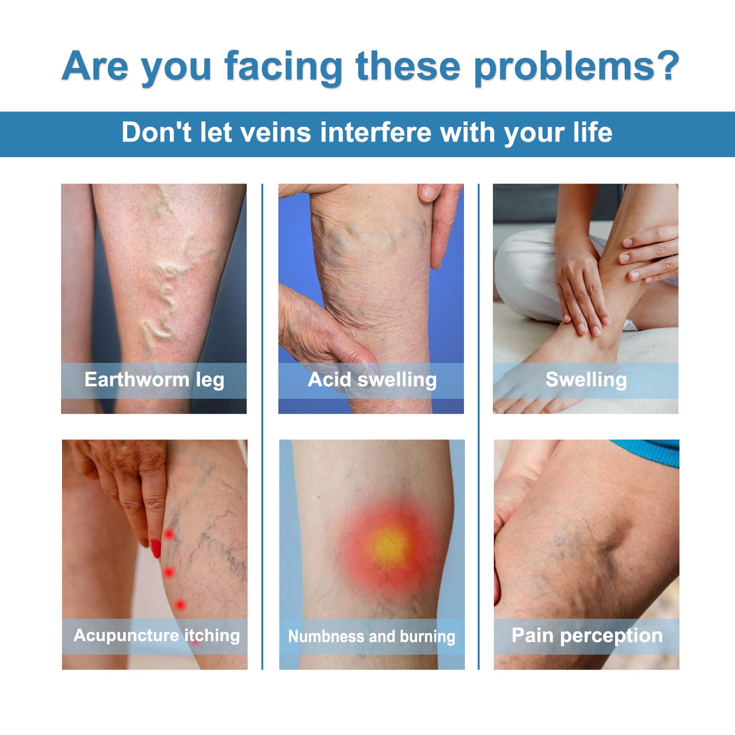 Vein Treatment Spray, Relieve Leg Soreness And Swelling Repair Earthworm Leg Vein Treatment Spray