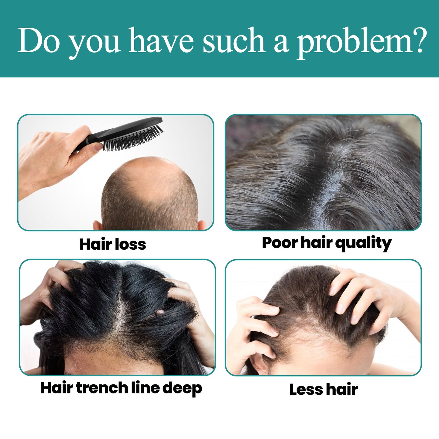 EELHOE Hair Care Essence, Nourishing And Moisturizing Hair, Soothing Hair And Scalp Massage Essence