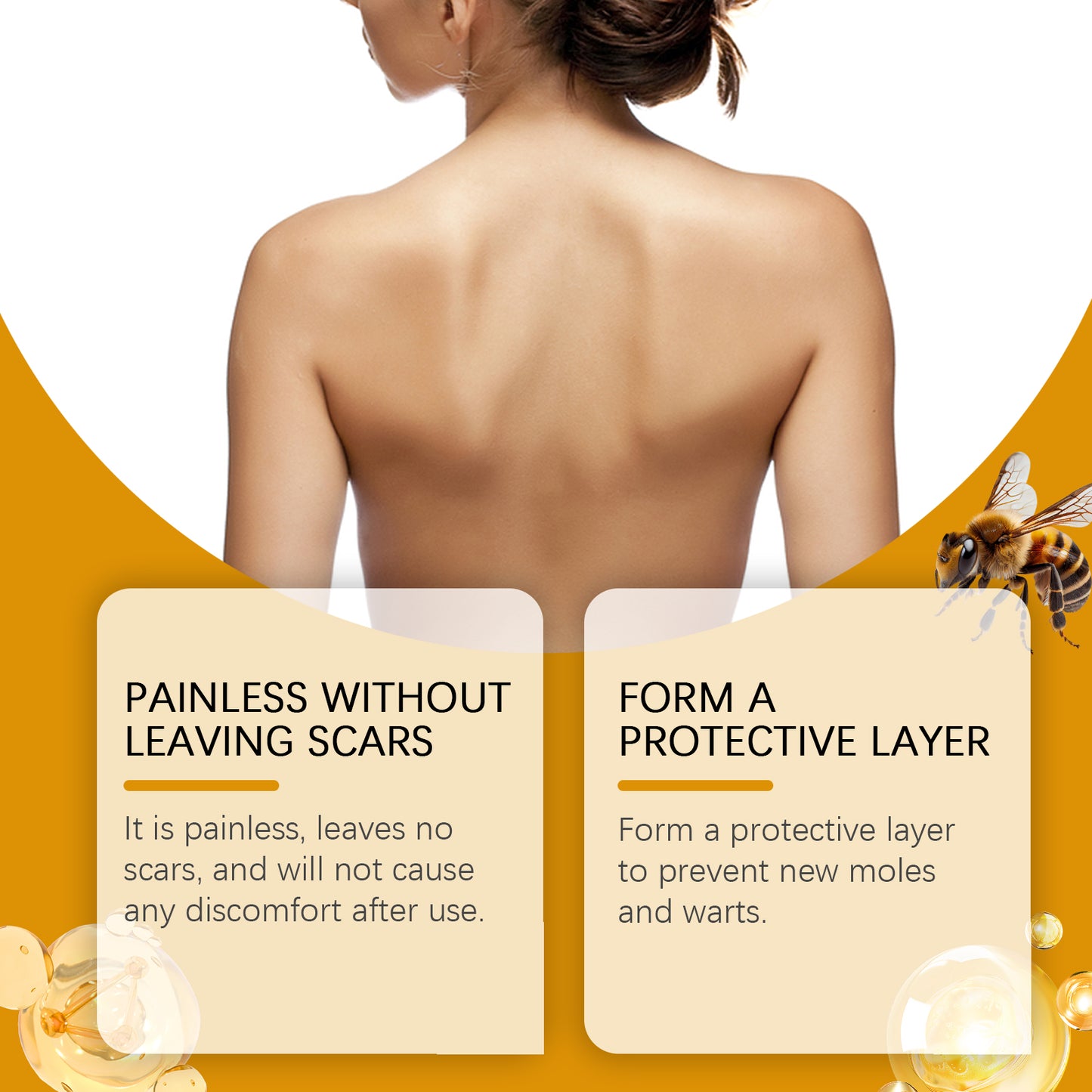 West&Month Bee Venom Keyu Mole Care Cream, Moisturizes And Smoothes The Skin, Lightening The Skin Flesh Granules And Body Care