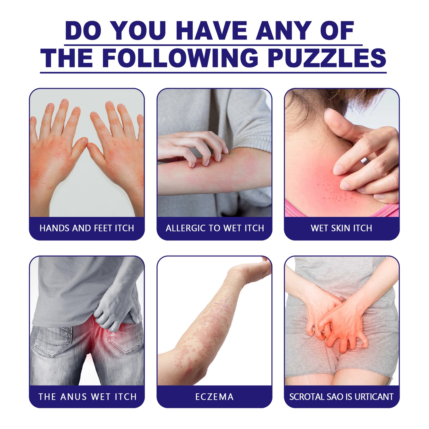 South Moon Zihuadidian Skin Care Cream For Mosquito Bites And Red Skin Topical Care Cream