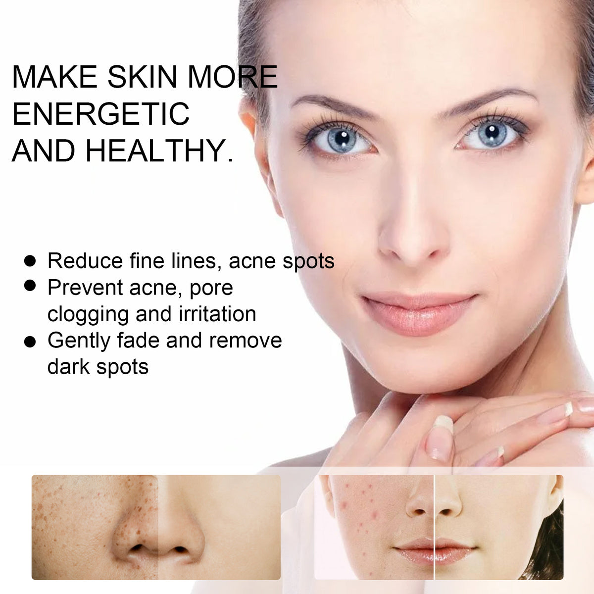 EELHOE Skin Care Cream Improves Dull Skin, Moisturizes Skin, Brightened Skin Care Cream And Clears Acne - American Smart