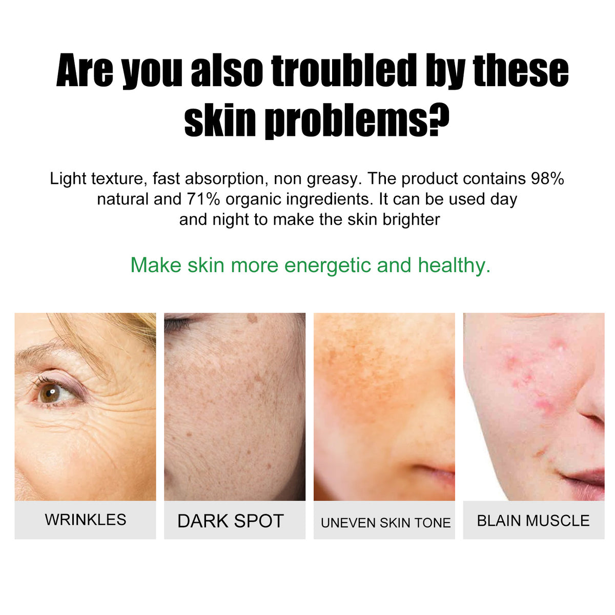 EELHOE Skin Care Cream Improves Dull Skin, Moisturizes Skin, Brightened Skin Care Cream And Clears Acne - American Smart