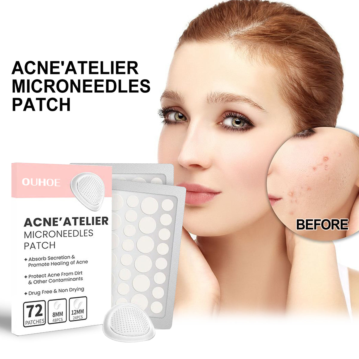 Acne Patch, Repair Acne Pimple Facial Redness Clean Pores Moisturize Skin Patch - American Smart