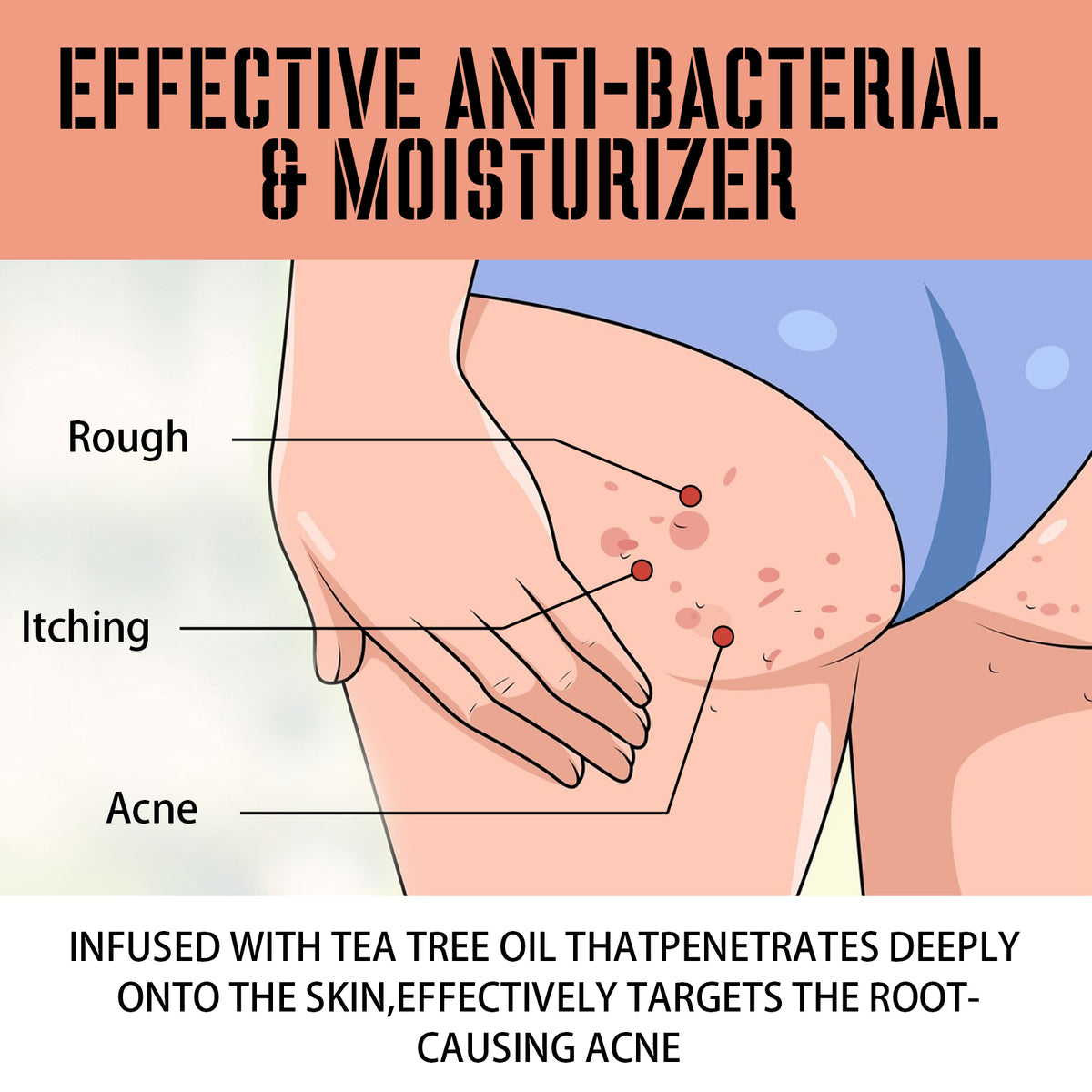 Buttock Care Cream, Repair Rough Buttock Skin Gentle Care Moisturizing And Moisturizing Skin - American Smart
