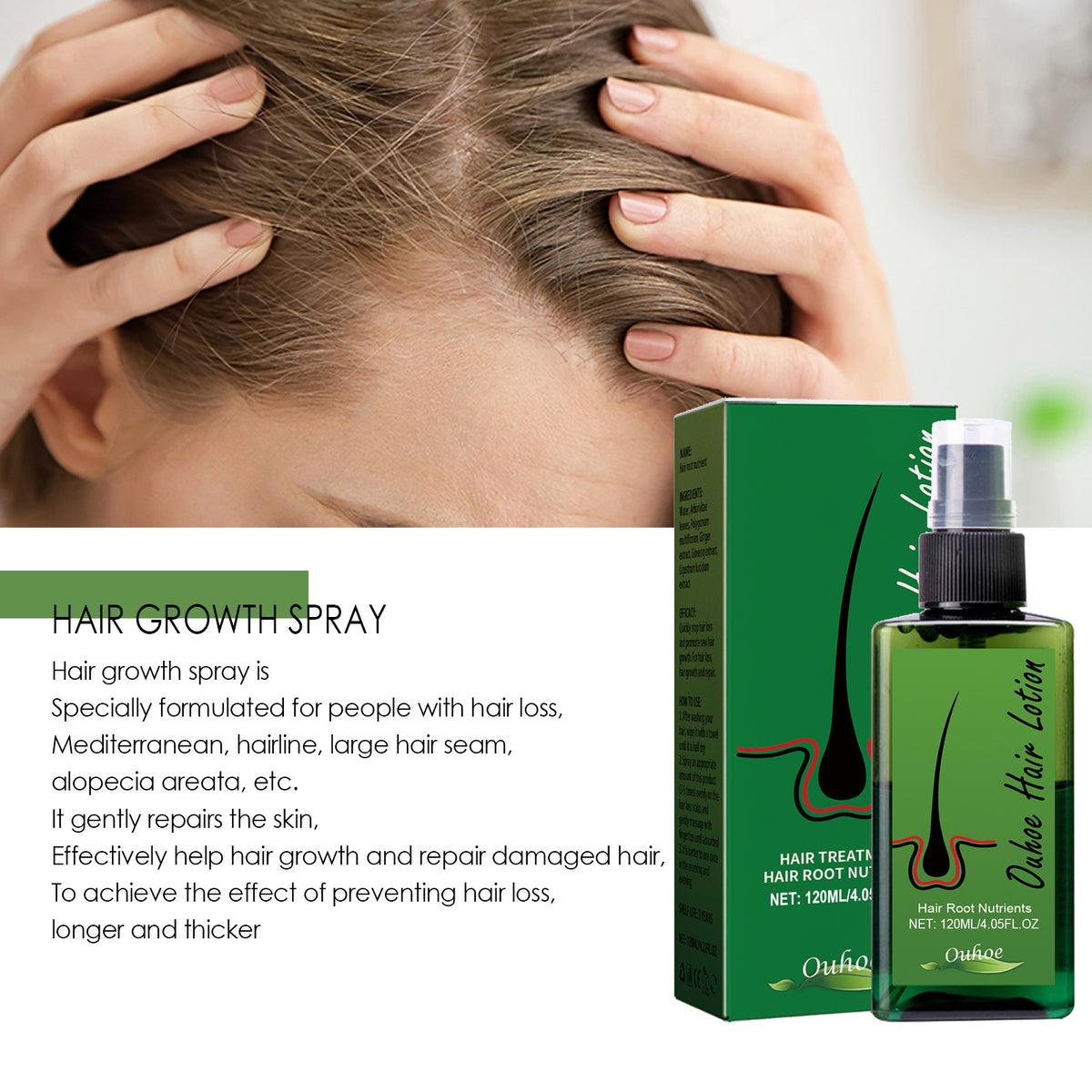 eprolo dense hair spray for anti-loss, hair strengthening, root repair, and hair care to promote thicker, healthier hair.
