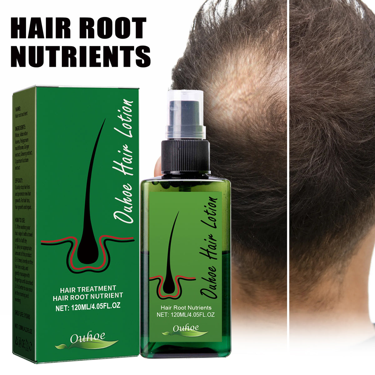 Eprolo dense hair spray for anti-loss, strengthening, and repairing hair, showing a spray bottle with a white and green label.