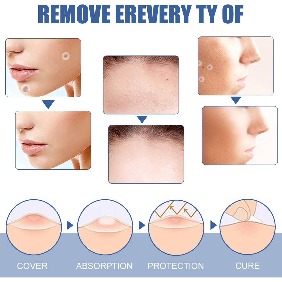 EELHOE Gram Wart Corns Patch by eprolo applied to skin for wart and mole removal, showing black and flesh-colored patches on skin
