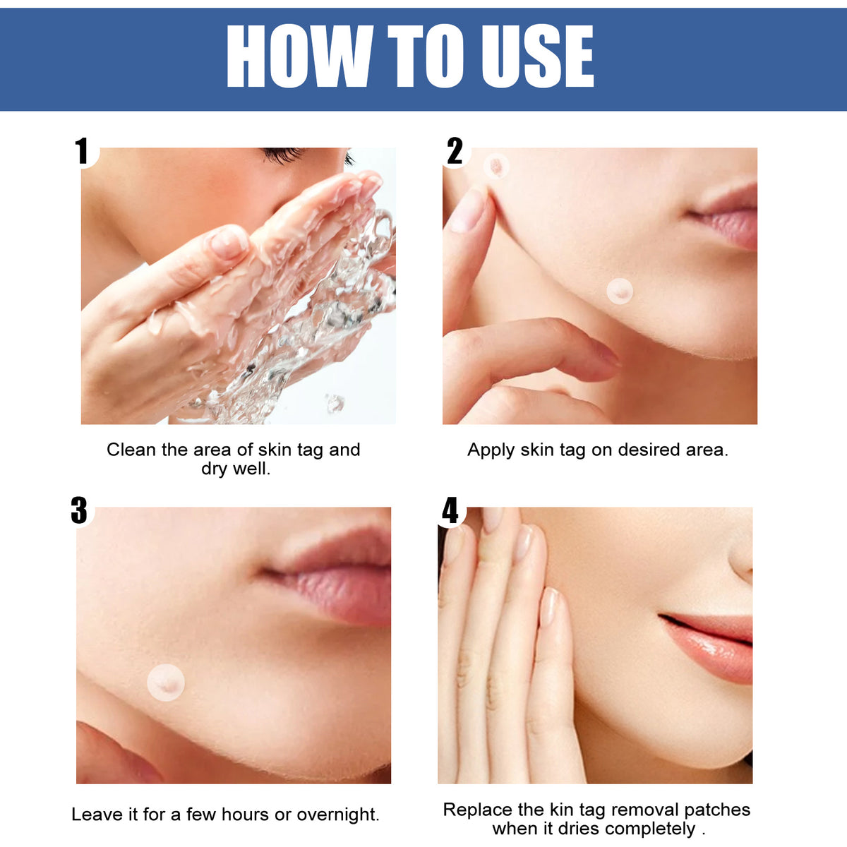 EELHOE Gram Wart Corns Patch by eprolo, skin care patch for removing warts, moles, and skin blemishes on the flesh.