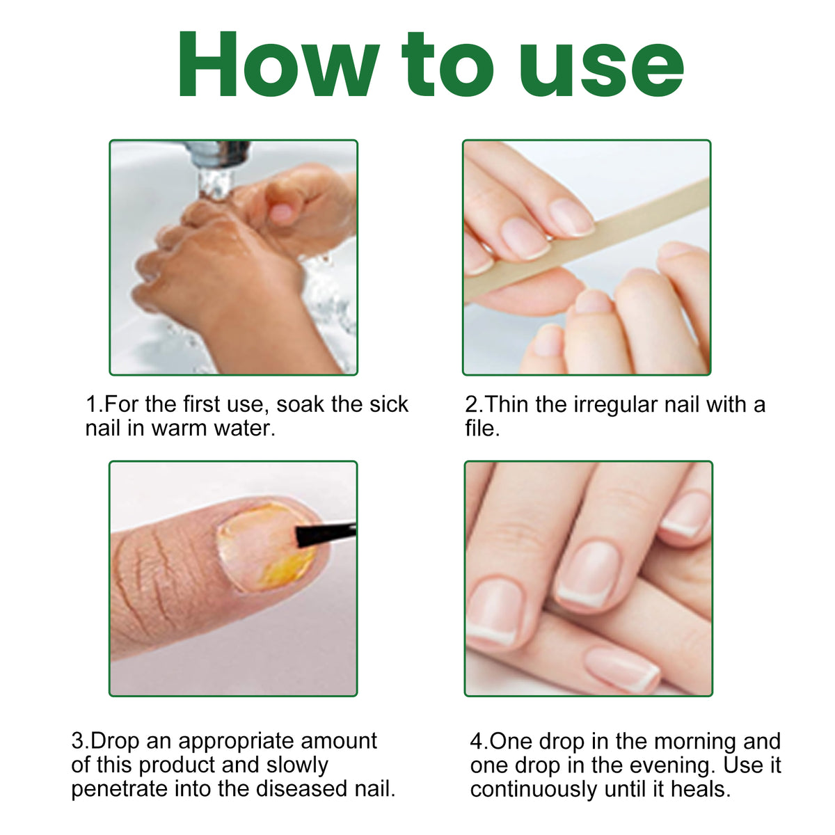 EELHOE Gray Nail Repair Remove Gray Nail Nourishing Lotion, Brightening Soft Nails Moisturizing Nail Care Solution For Hands, Feet And Nails - American Smart