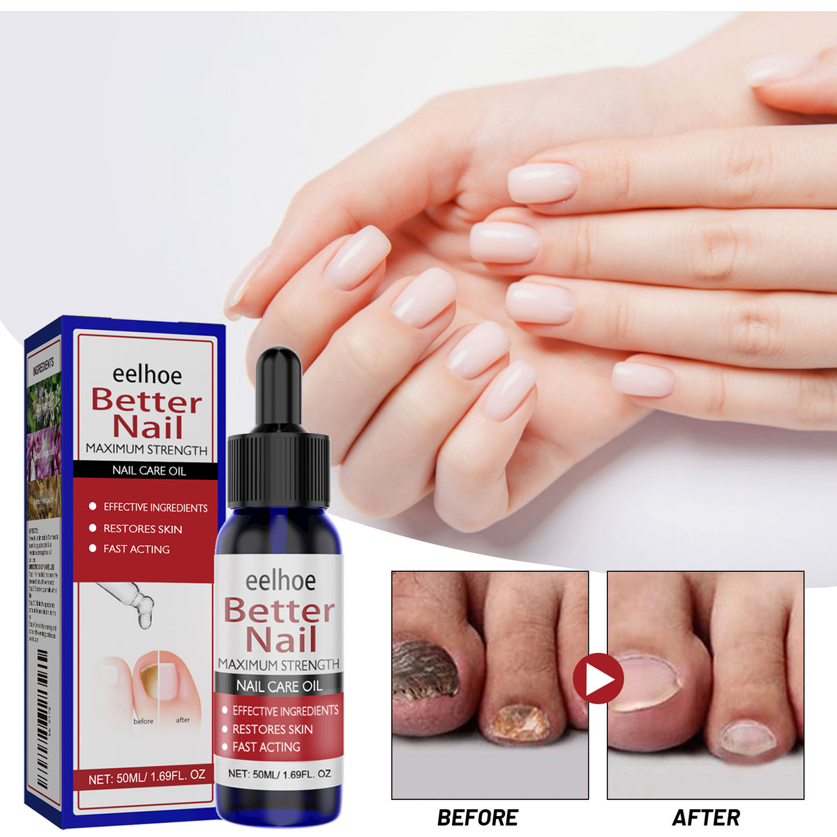 EELHOE Nail Repair Solution, Hands And Feet Nail Repair Moisturizing Clean And Remove Gray Nail Repair Solution - American Smart