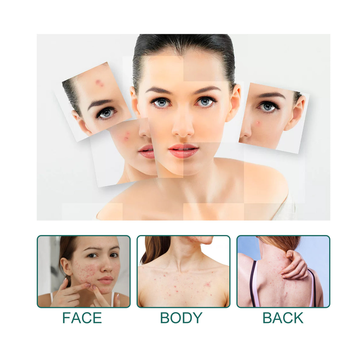 EELHOE Star Acne Patch Gentle Cleansing Lighten Acne Soothing Skin Acne Patch Facial Cleansing Treatment - American Smart