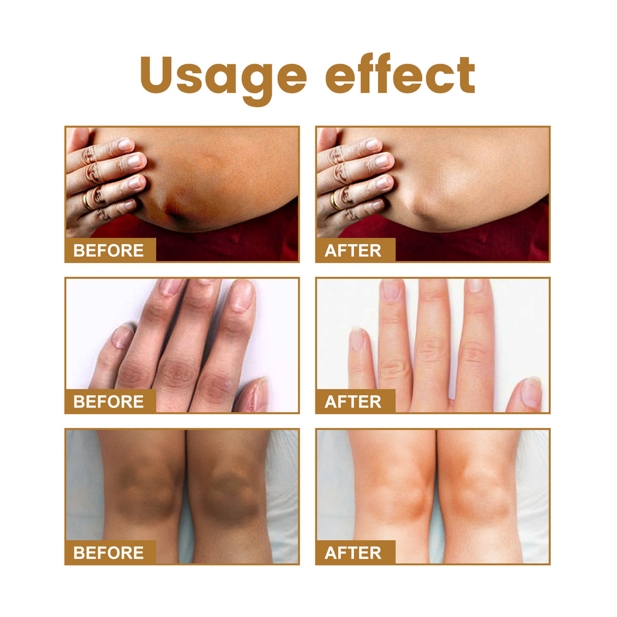 Jaysuing Melanin Whitening Serum for hands and joints by eprolo, featuring a sleek bottle with applicator for skin brightening.
