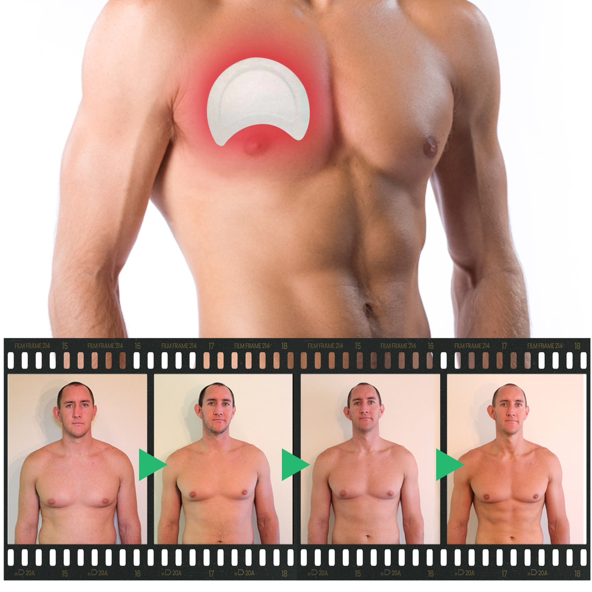 Men's chest fat burner patch by eprolo, showing the patch applied to the chest for firming and anti-sagging massage care.