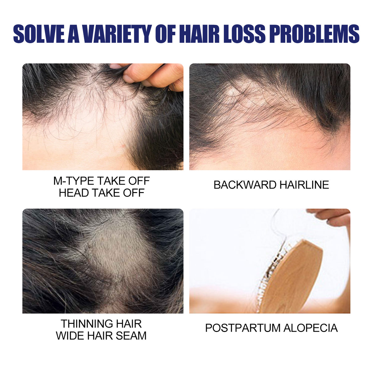Men's dense hair foam machine by eprolo showing a device for repairing hair roots and adding thick, moisturizing foam to men's hair.