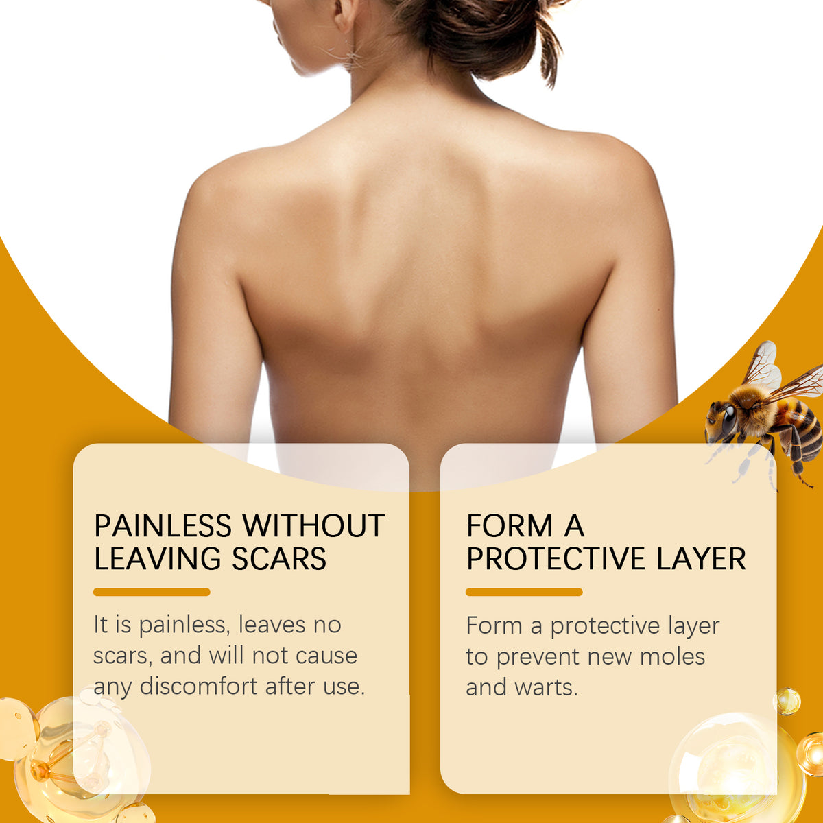 Eprolo West&Month Bee Venom Keyu Mole Care Cream jar with smooth cream for skin moisturizing and lightening skin tone.